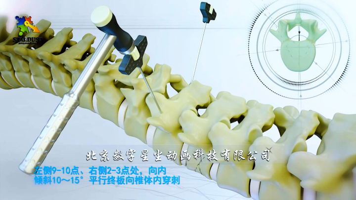 空心设计