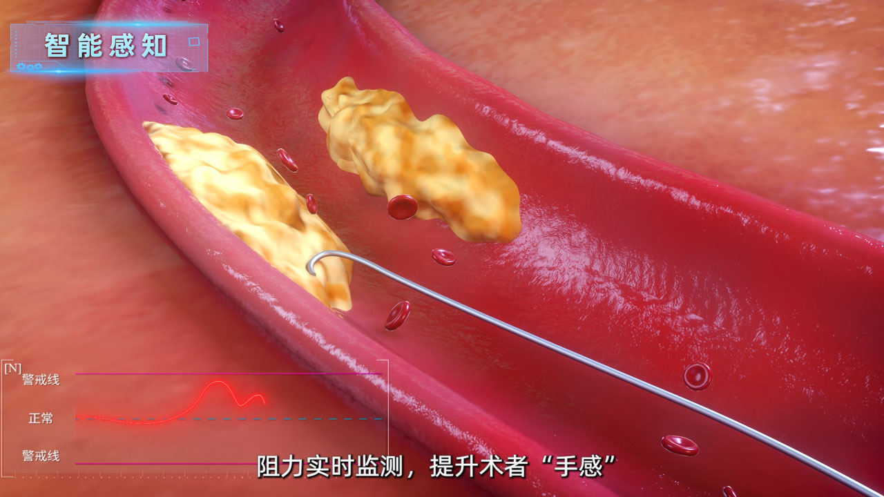 微观血管